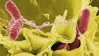 salmonella.jpg