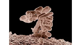 USDA study aims to facilitate traceability during investigations of foodborne outbreak