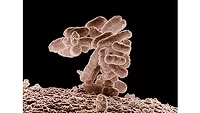 USDA study aims to facilitate traceability during investigations of foodborne outbreak