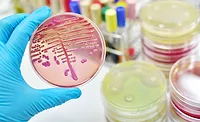 hand holding microbial, food safety