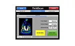 YieldScan reading