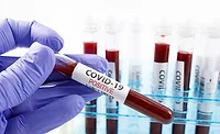 blood vials blood vials
