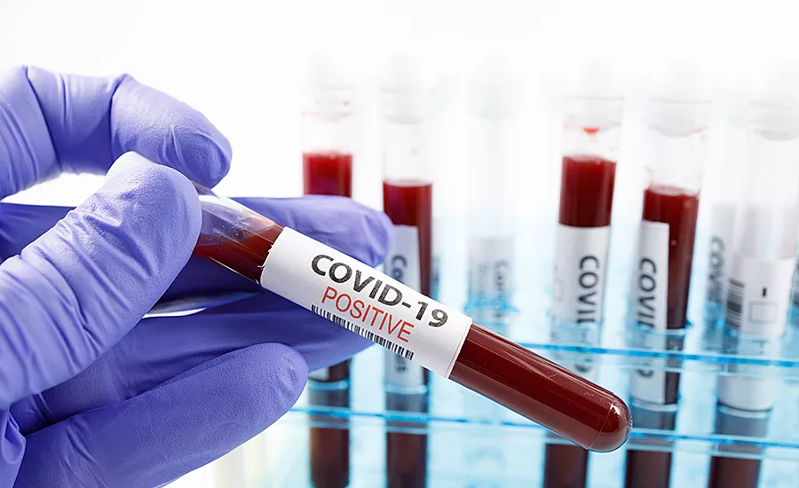 blood vials