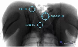 x-ray