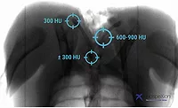 x-ray