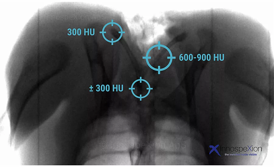 x-ray