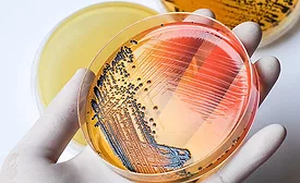 petri dish