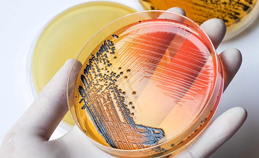 petri dish