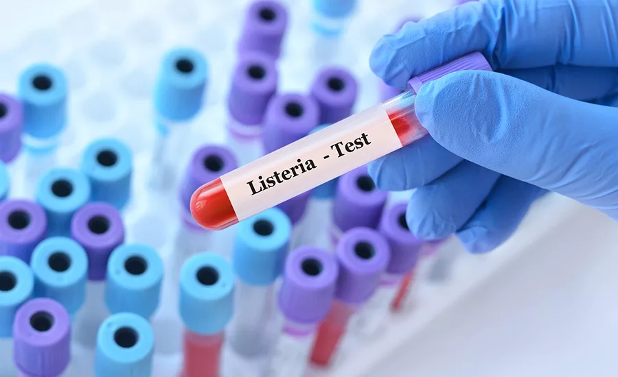 Gloved hand holding a test tube labeled "Listeria - Test". A group of blue and purple capped test tubes in the background.