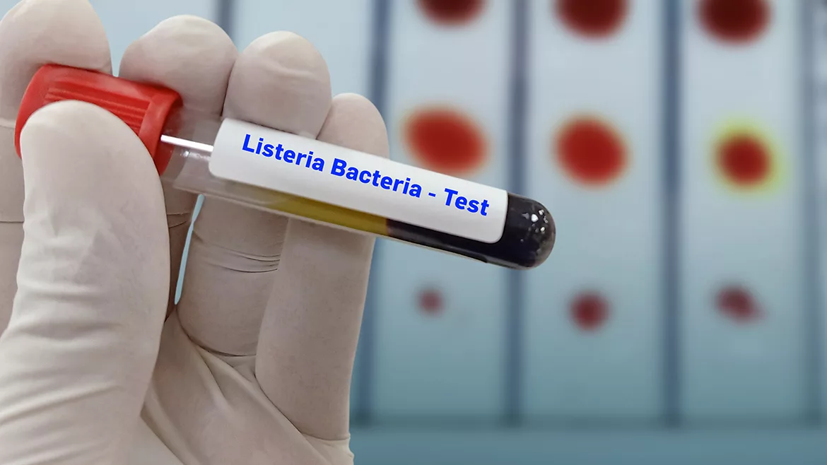 Close up image of a gloved hand holding a test tube with a blood sample with a label that reads Listeria Bacteria - Test.