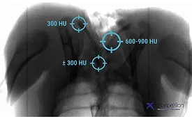 InnoSpexion X-ray inspection