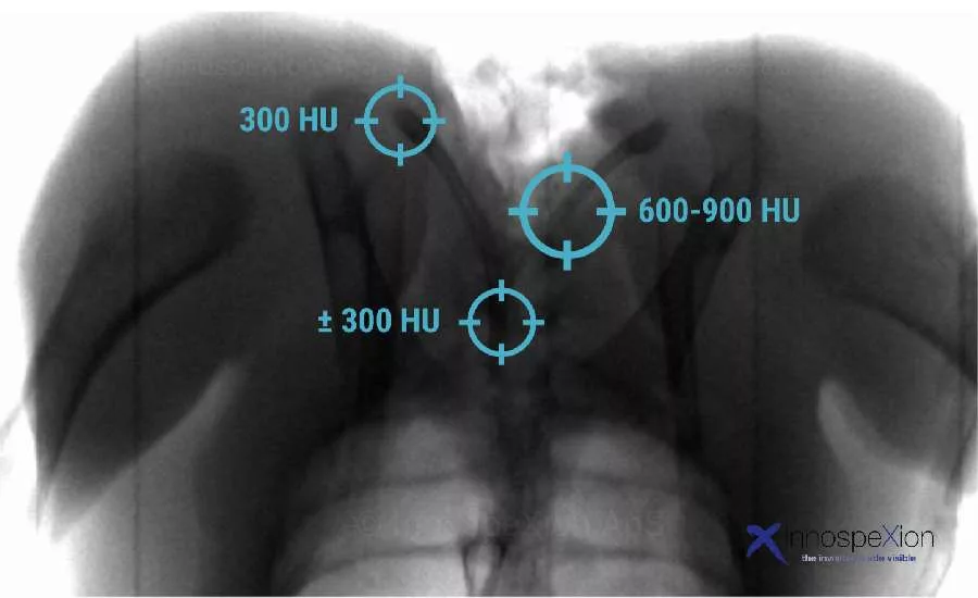 InnoSpexion X-ray inspection